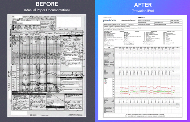 iprobeforeandafter